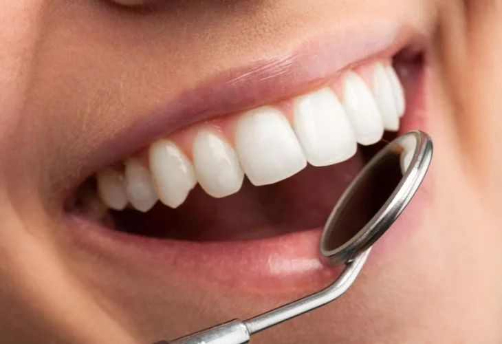 Dentística Estética